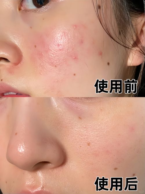 适合追求年轻肌肤的人OG真人抗皱面霜十大(图3)