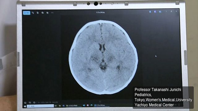 创25年新高大S不幸去世儿童是重灾区OG真人平台日本流感大爆发！病例数(图5)