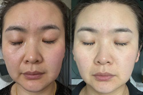 国货前三：这些平价抗衰品牌值得拥有OG真人平台抗老抗衰护肤品排行榜！(图6)